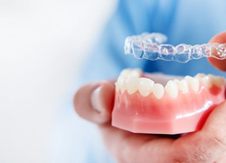 a person holding Invisalign aligners over a model of teeth