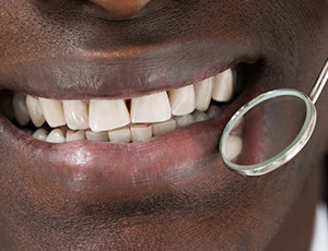 Closeup of healthy smile during exam