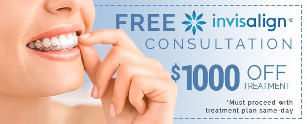 Coupon for free Invisalign consultation and $1000 off treatment