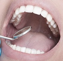 Closeup of wide open mouth during dental treatment